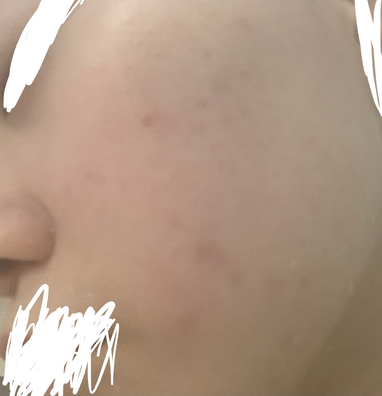 ダイブイン セラム/Torriden/美容液を使ったクチコミ（3枚目）