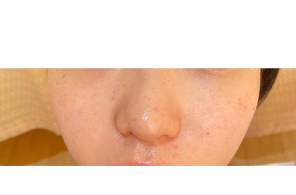 化粧水 敏感肌用 さっぱりタイプ/無印良品/化粧水を使ったクチコミ(4枚目)