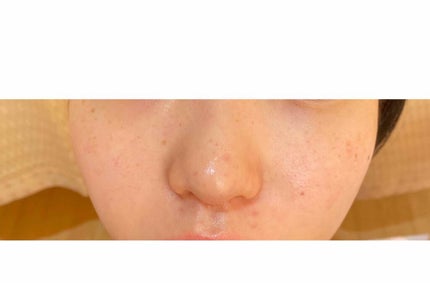 化粧水 敏感肌用 さっぱりタイプ/無印良品/化粧水を使ったクチコミ(4枚目)