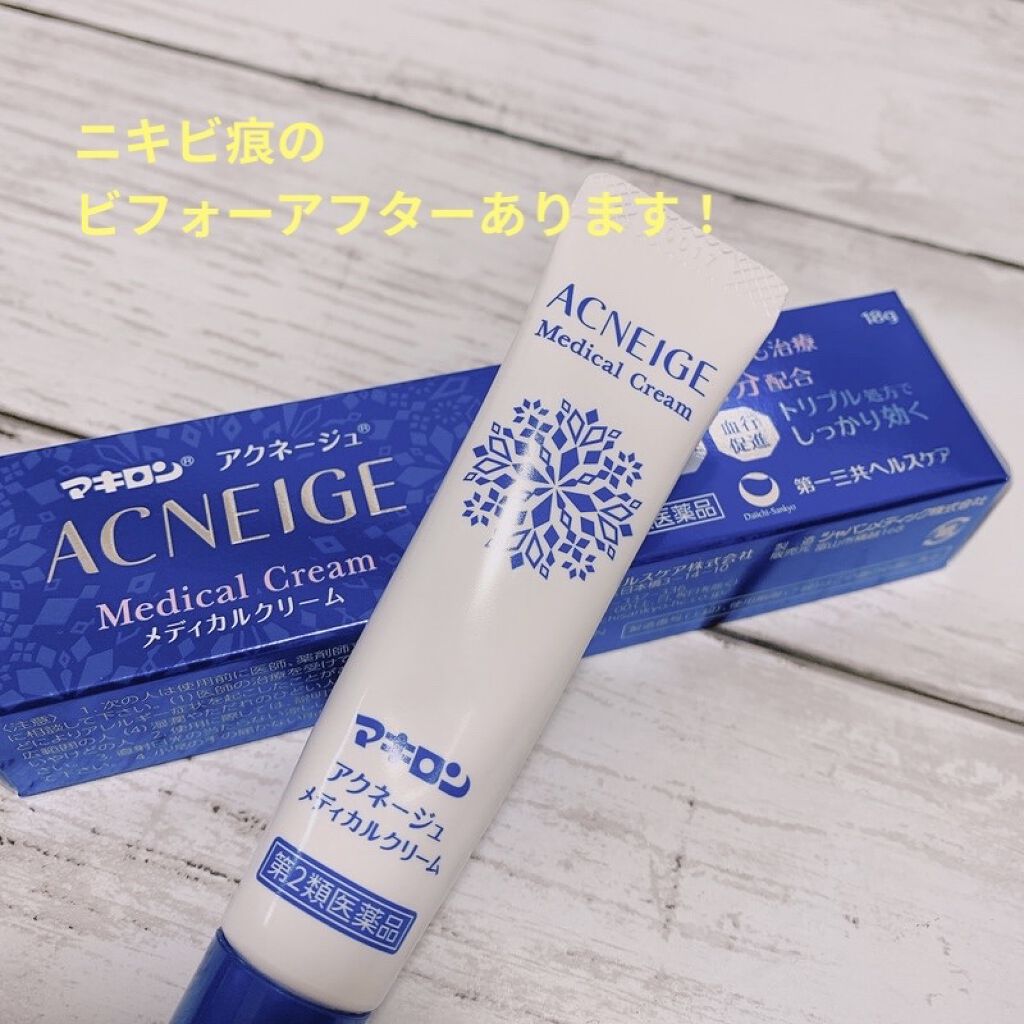  マキロン アクネージュ メディカルクリーム	(医薬品）	/マキロン/その他を使ったクチコミ（1枚目）