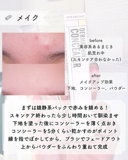 ダーマシンコンシーラー/23years old/リキッドコンシーラーを使ったクチコミ(4枚目)