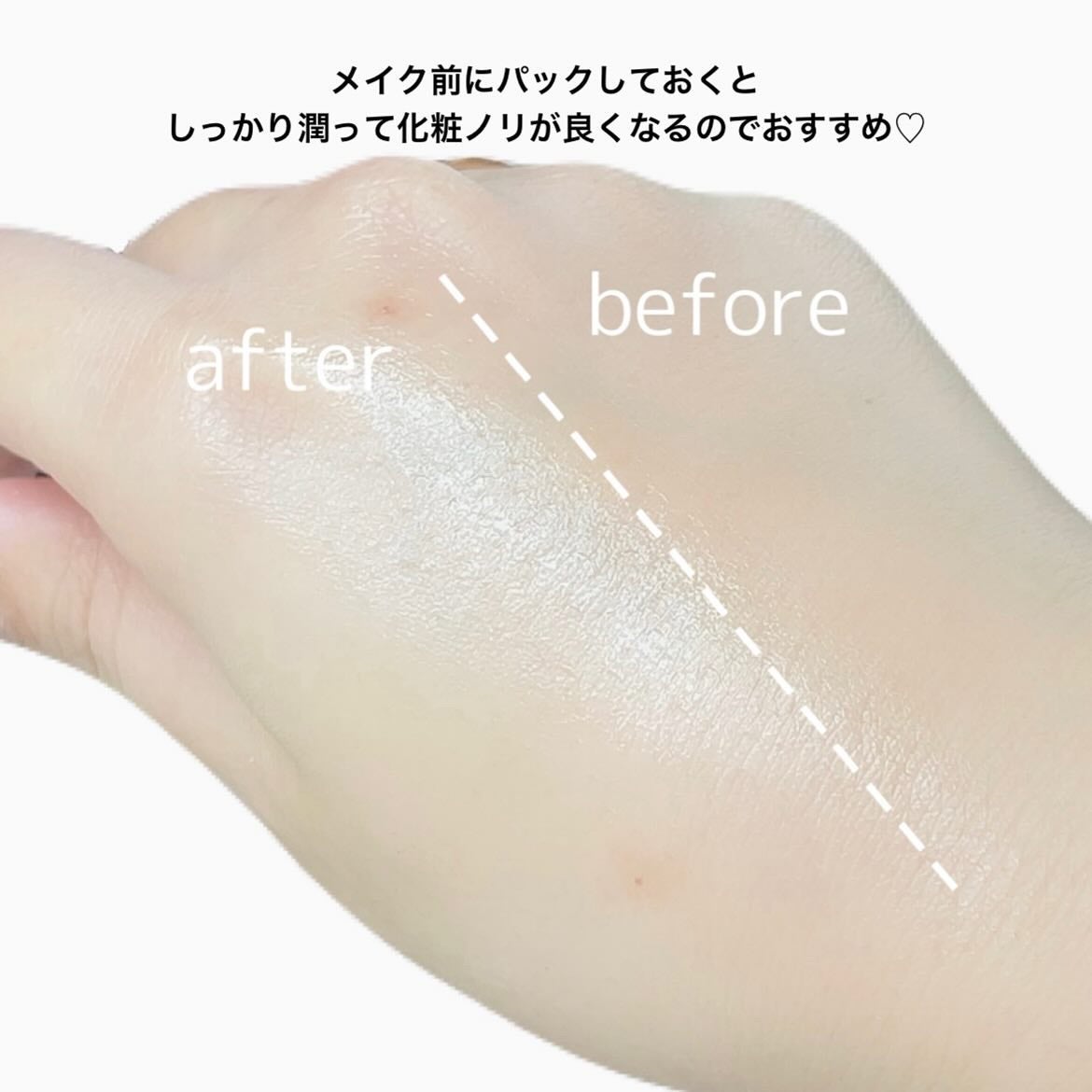 ポストアルファクーリングパッド/Cell Fusion C(セルフュージョンシー)/トナーパッドを使ったクチコミ(5枚目)