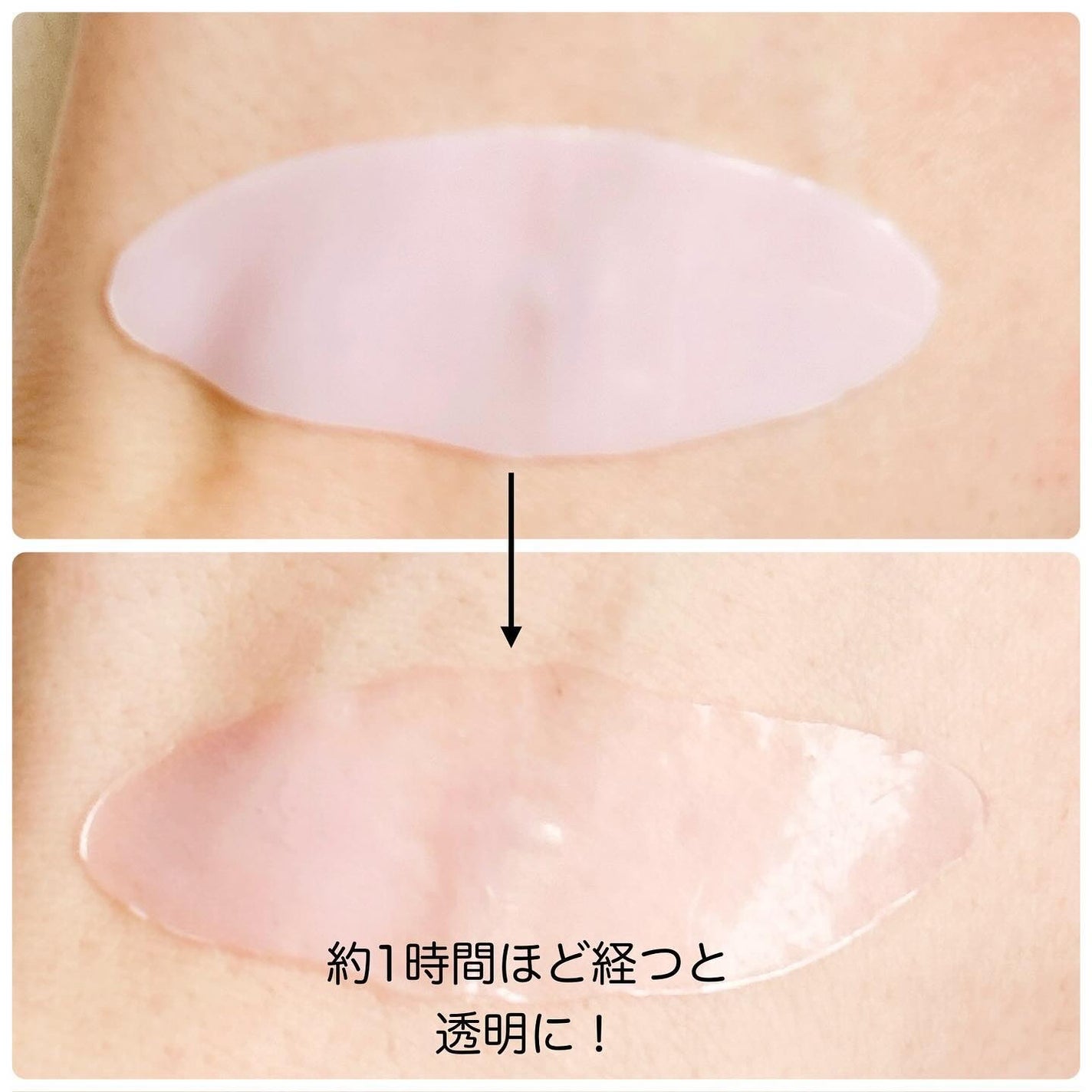 PDRNピンクコラーゲンゲルマスク/MEDICUBE/シートマスク・パックを使ったクチコミ(10枚目)