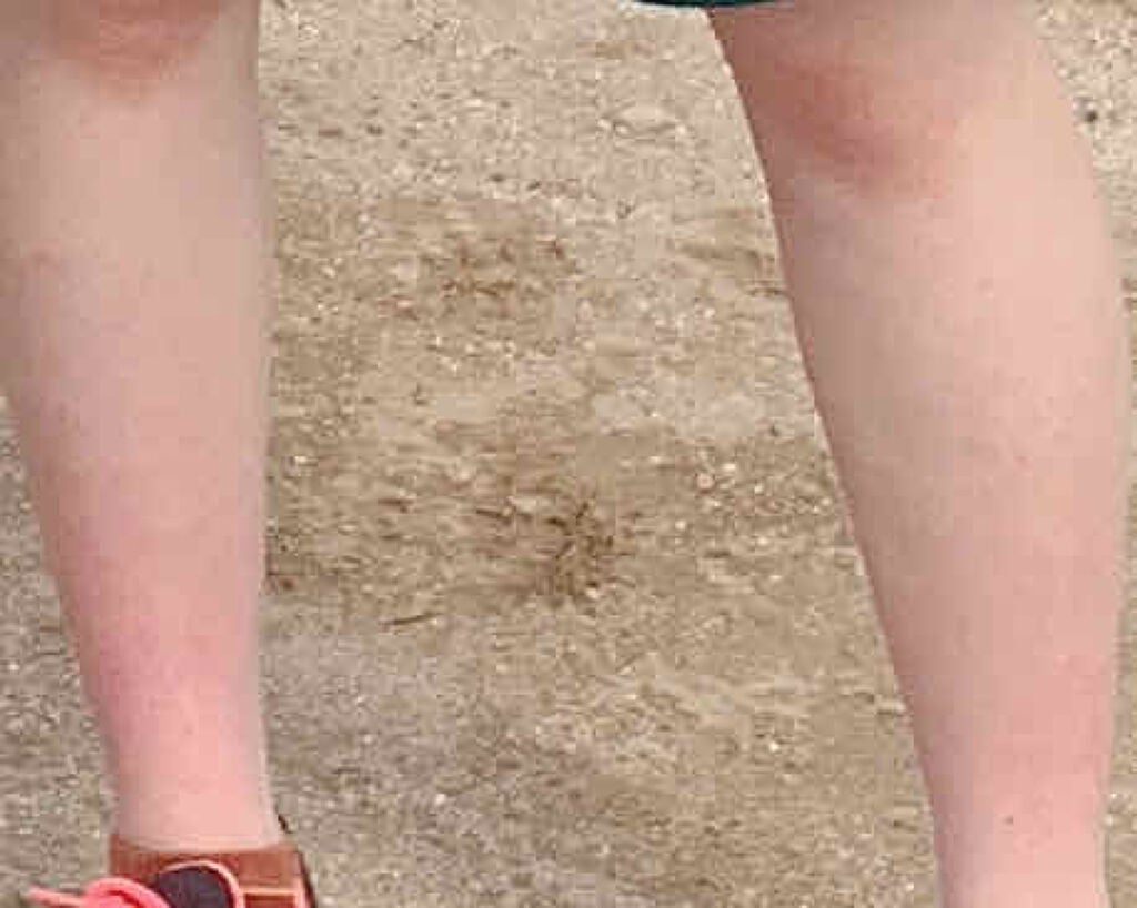 EGG SHOT/KINUJO/美顔器・マッサージを使ったクチコミ(3枚目)