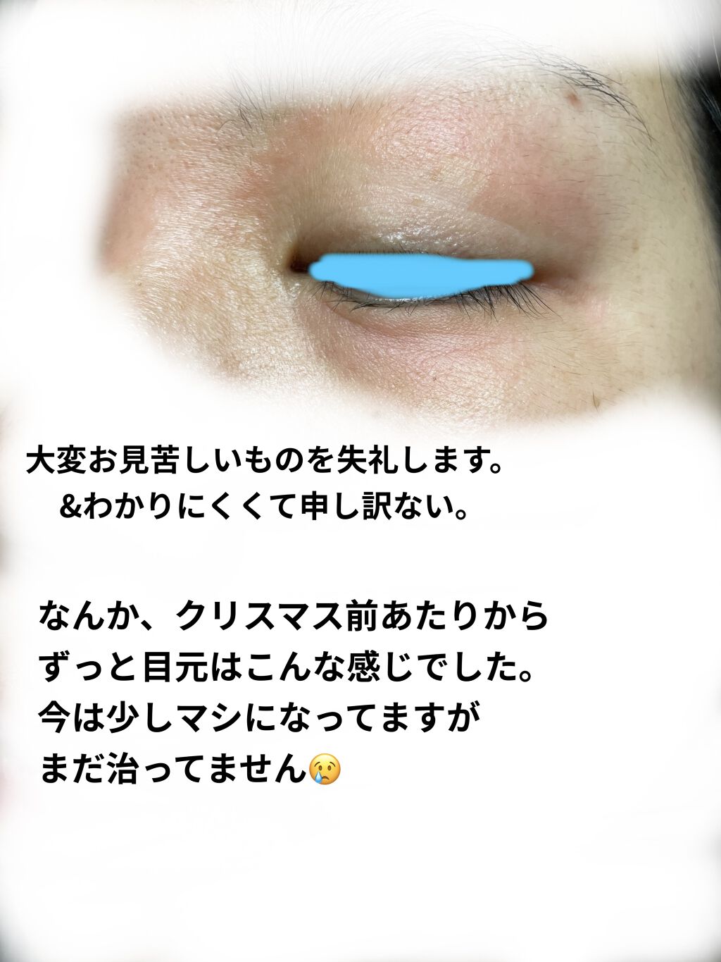 潤浸保湿 化粧水 II しっとり/キュレル/化粧水を使ったクチコミ（3枚目）