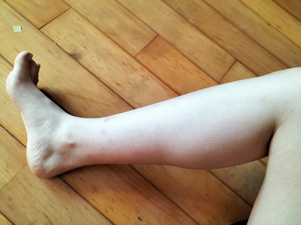 momo ෆ on LIPS 「ひなちゃんねる様脚やせ動画8回目。昨日もちゃんとやりました写真..」(1枚目)