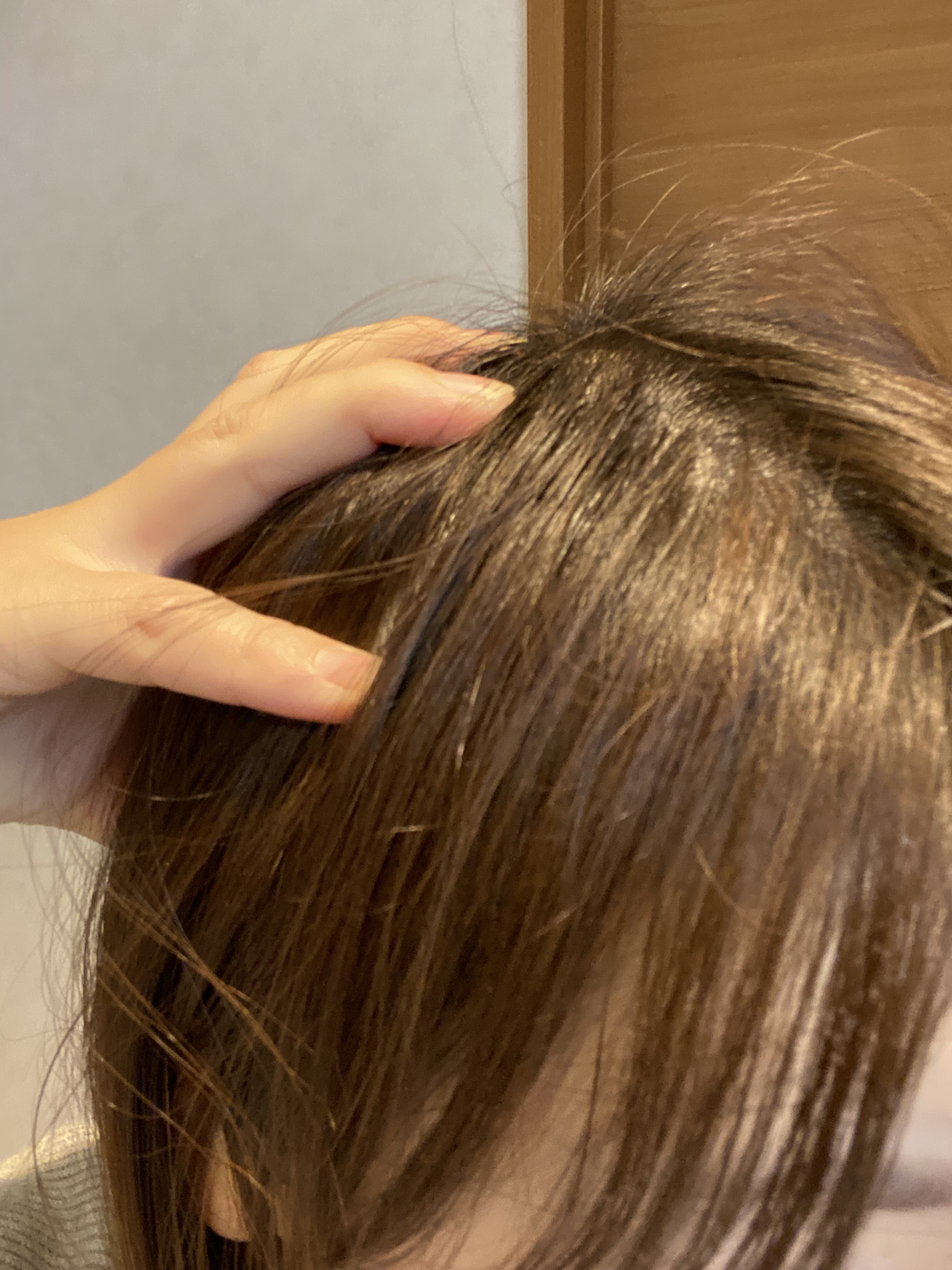 ヘアージュ 育毛剤 ヘアエッセンス/hairju/頭皮ローションを使ったクチコミ（3枚目）