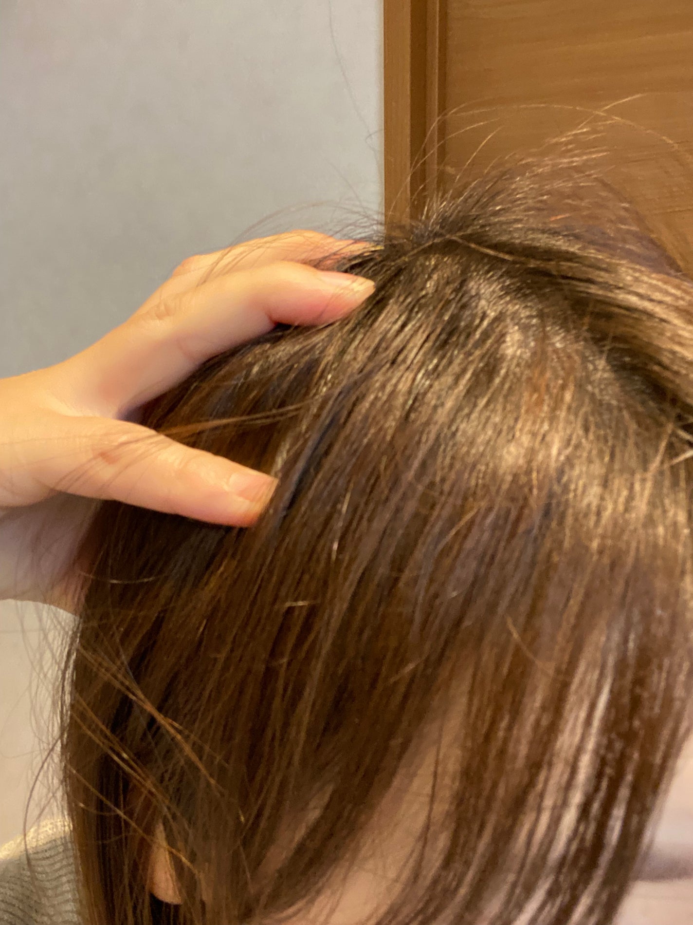 ヘアージュ 育毛剤 ヘアエッセンス/hairju/頭皮ローションを使ったクチコミ(3枚目)