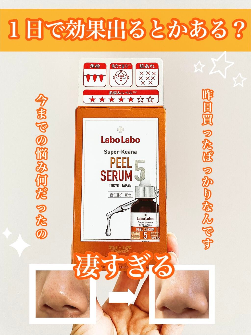 スーパー毛穴ピールセラム/ラボラボ/美容液を使ったクチコミ(1枚目)