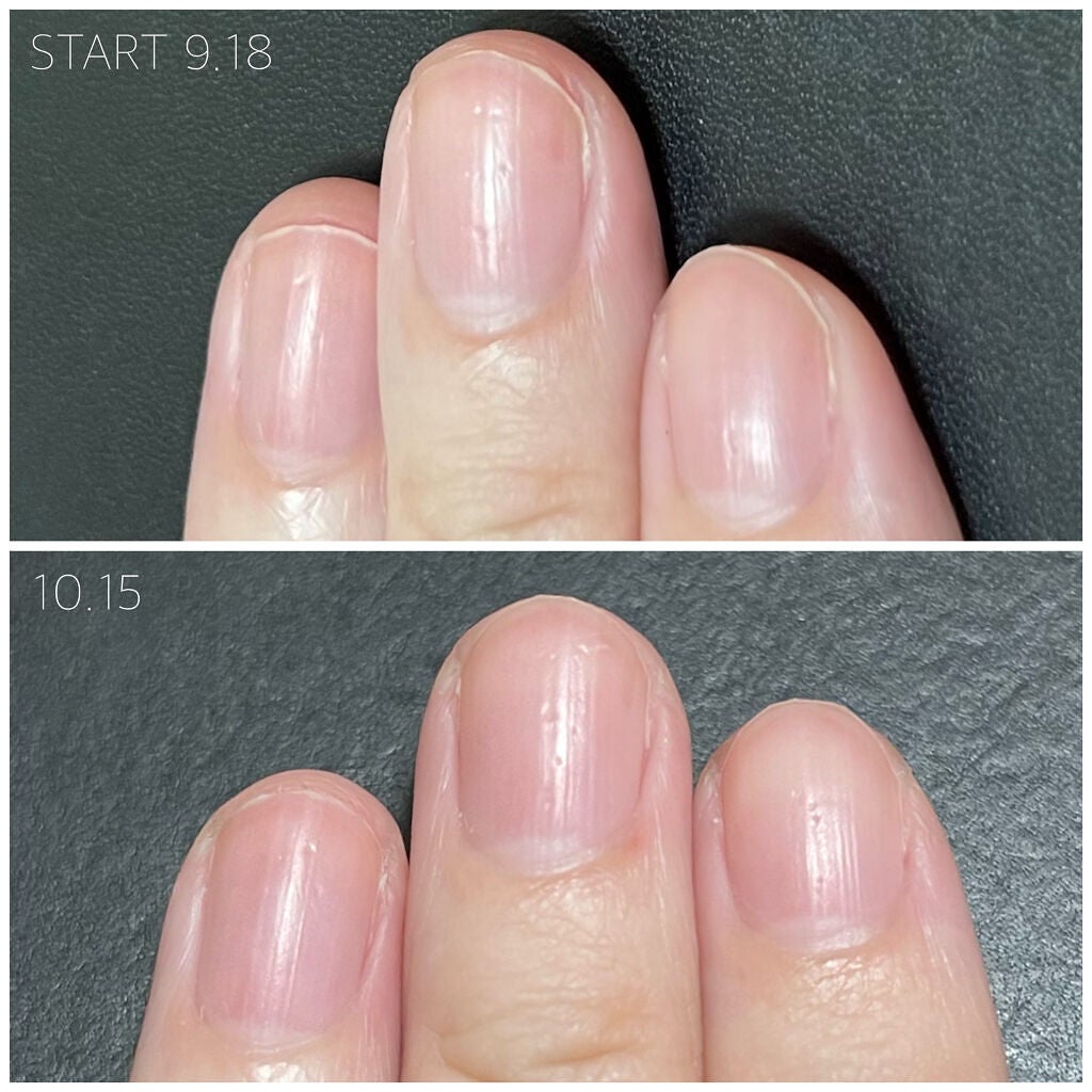 ディープセラム/Dr.Nail/ネイルオイル・トリートメントを使ったクチコミ(5枚目)