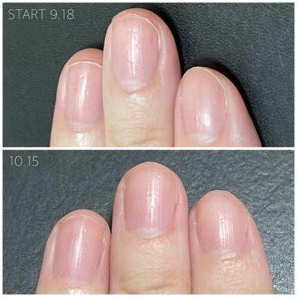 ディープセラム/Dr.Nail/ネイルオイル・トリートメントを使ったクチコミ(5枚目)