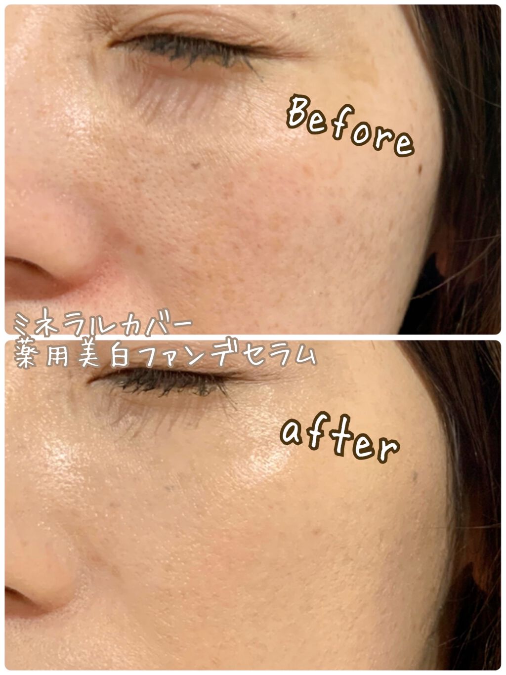 ミネラルカバー薬用美白ファンデセラム/ミリオナ化粧品/美容液を使ったクチコミ(5枚目)