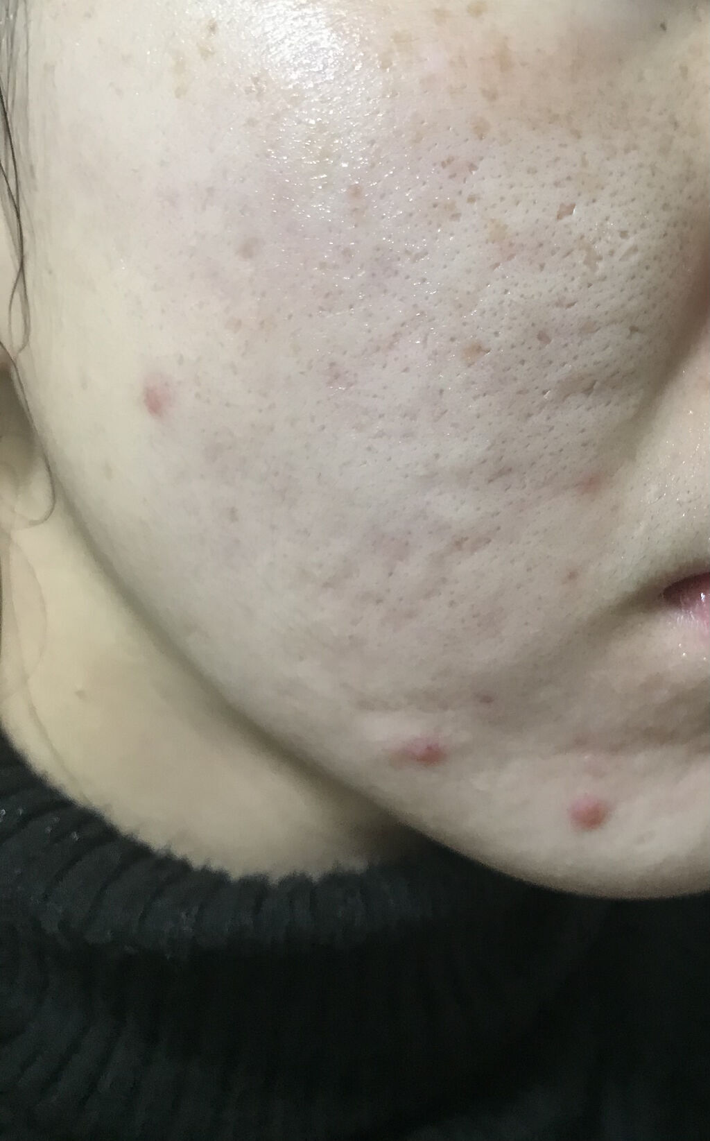 を使ったクチコミ（1枚目）