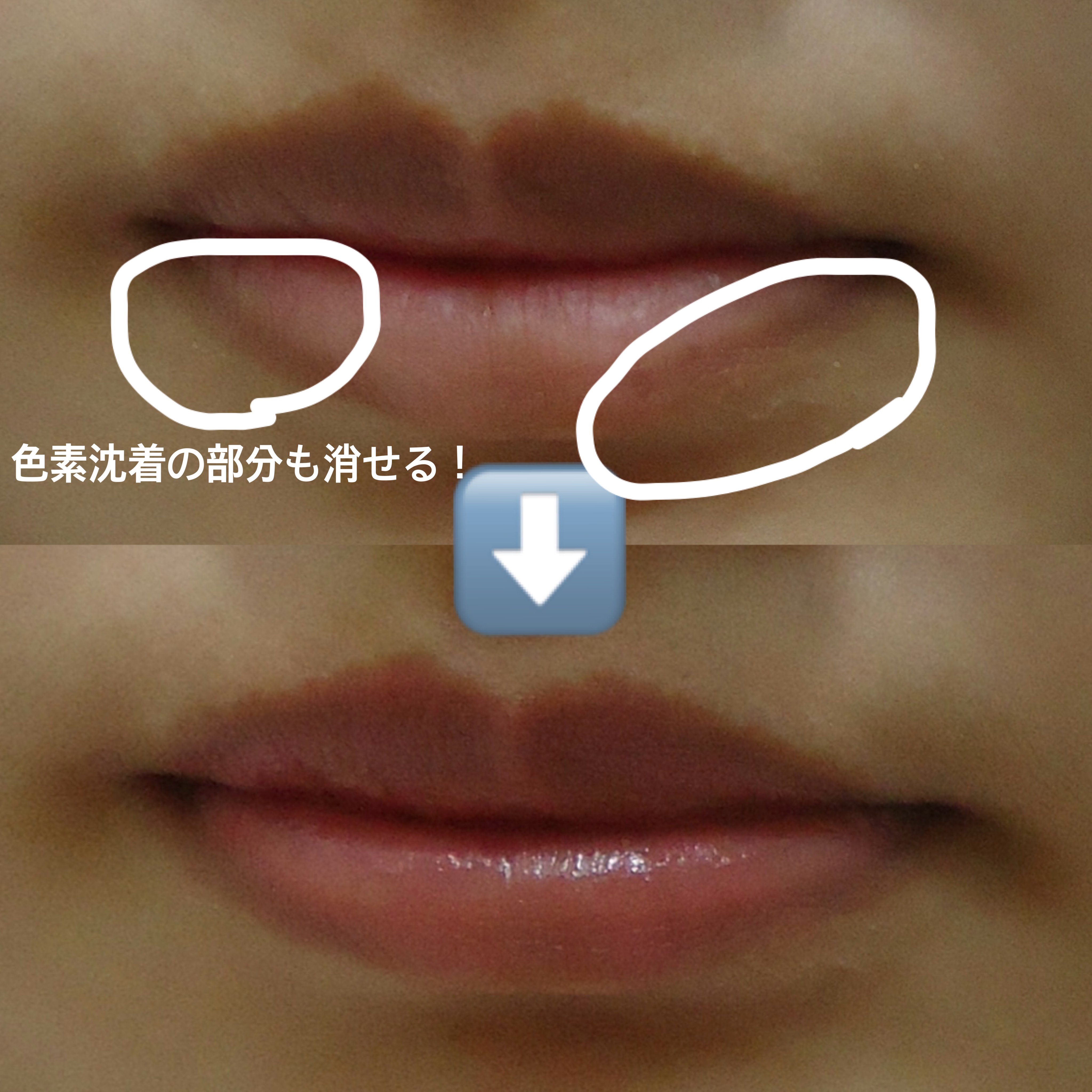 ディオール アディクト リップ マキシマイザー/Dior/リップグロスを使ったクチコミ（2枚目）