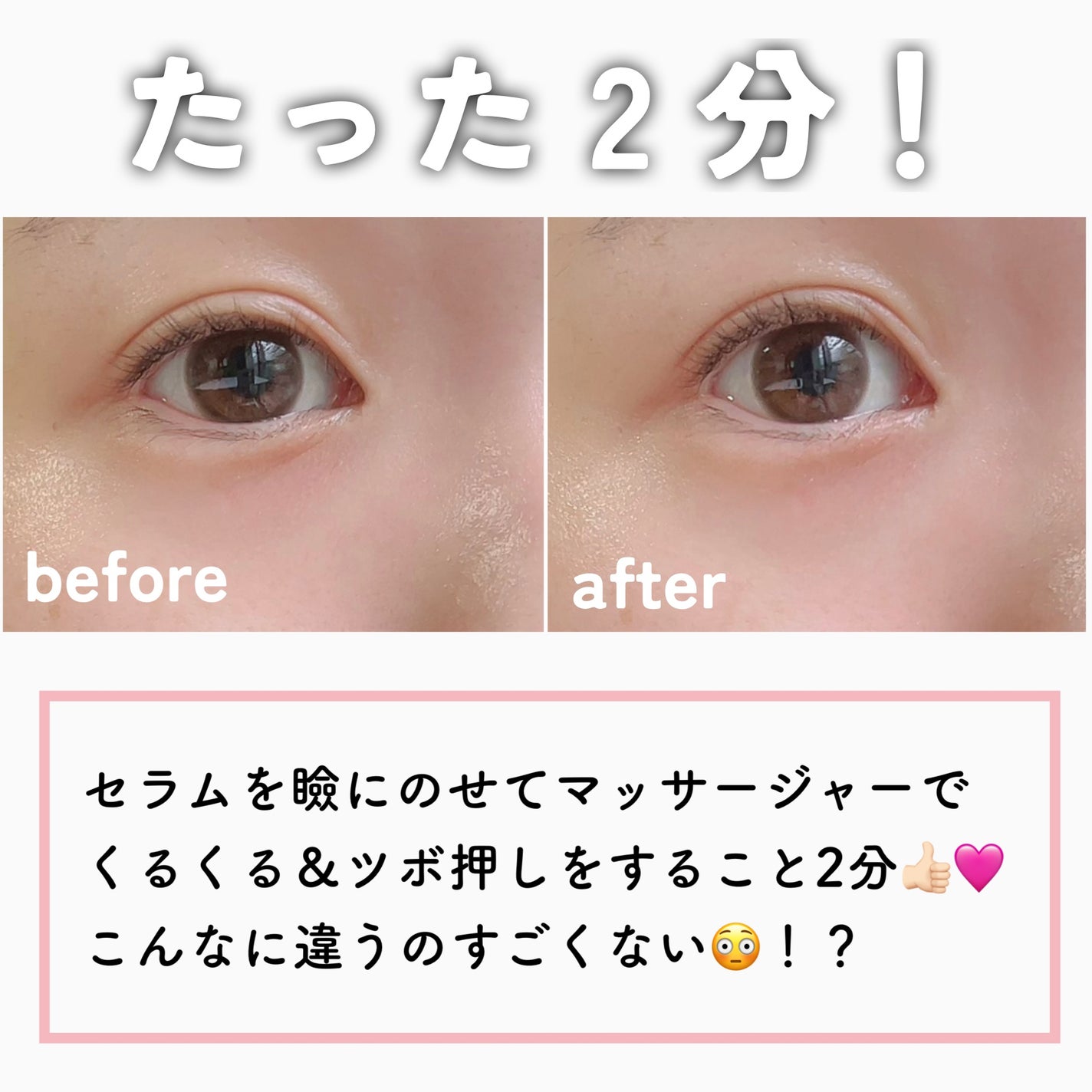 リポソーム アドバンスト リペアアイセラム/DECORTÉ/アイケア・アイクリームを使ったクチコミ(5枚目)