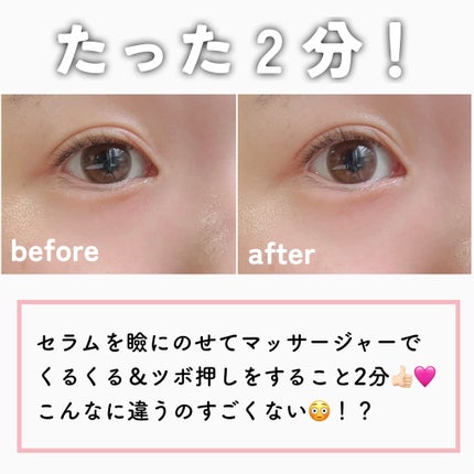 リポソーム アドバンスト リペアアイセラム/DECORTÉ/アイケア・アイクリームを使ったクチコミ(5枚目)