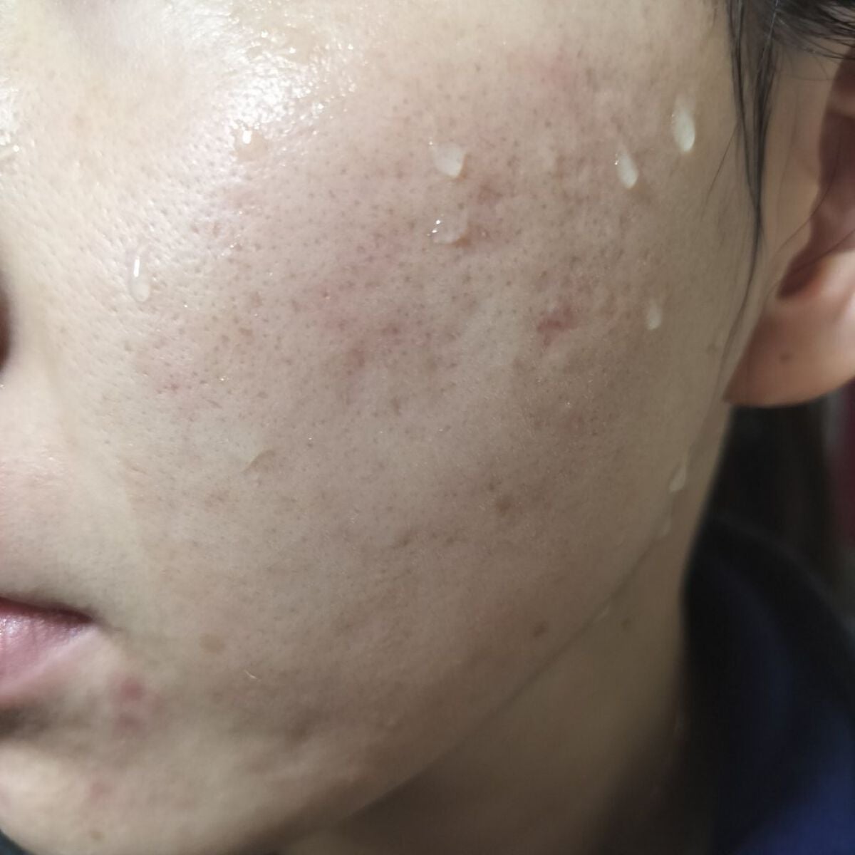 miina@汚肌工事録⚠️ on LIPS 「10/13の#汚肌工事録いつもありがとう💕/スキンケア❤☀朝#..」(2枚目)