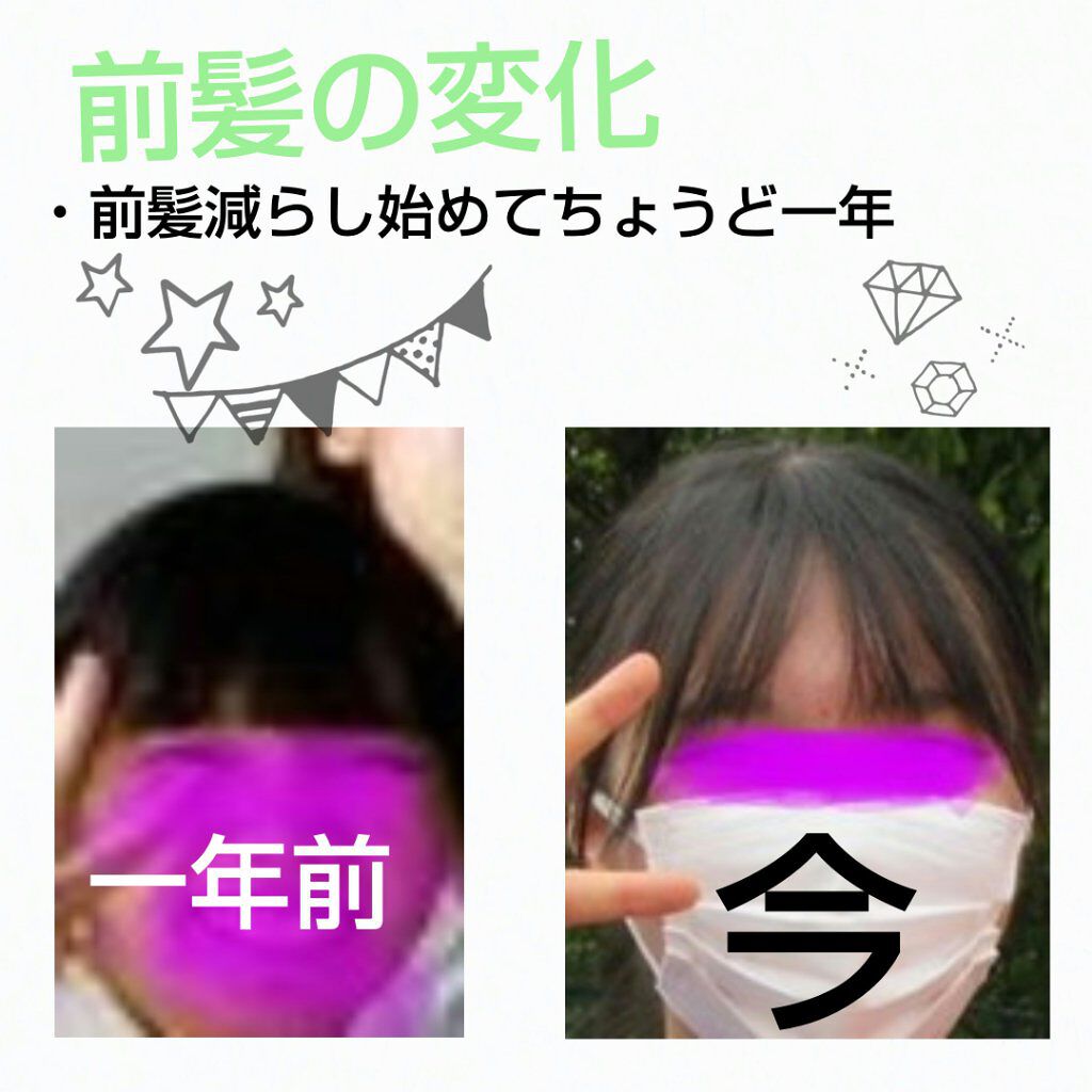 まゆお on LIPS 「こんにちは!まゆおです!!今日で前髪減らし始めてちょうど一年に..」(1枚目)