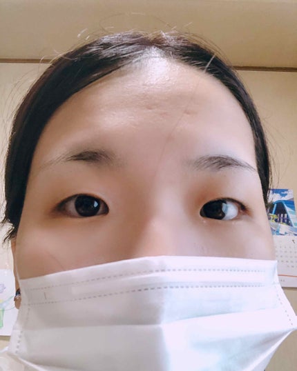 のびーるアイテープ(絆創膏タイプ、レギュラー)/DAISO/二重まぶた用アイテムを使ったクチコミ(1枚目)