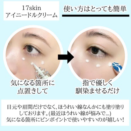 高濃度ビタミンC/17skin/美容サプリメントを使ったクチコミ(4枚目)