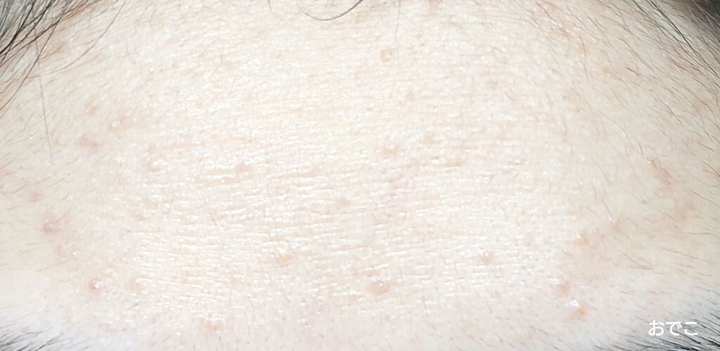 チョコラBBプラス (医薬品)/チョコラBB/その他を使ったクチコミ（3枚目）