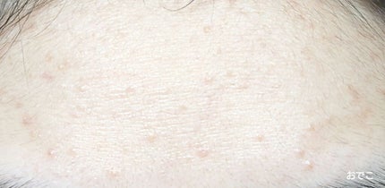 DHC ビタミンCハードカプセル/DHC/美容サプリメントを使ったクチコミ(3枚目)