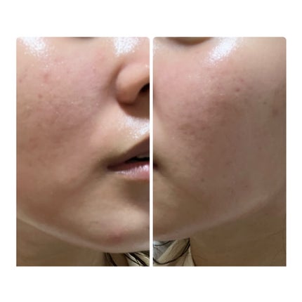 を使ったクチコミ(2枚目)