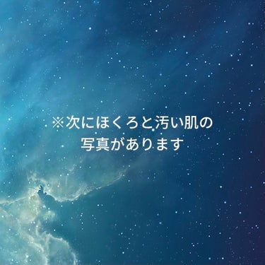 ザセムのコンシーラー買ったけど上手く使えない…
やっぱりこの大きさだと隠すのは無理なのかな😭

おすすめの使い方があったら教えてください💦

#雑談_相談 