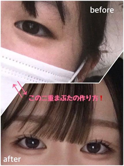 半透明で目立ちにくいキズテープ/matsukiyo/その他を使ったクチコミ(1枚目)