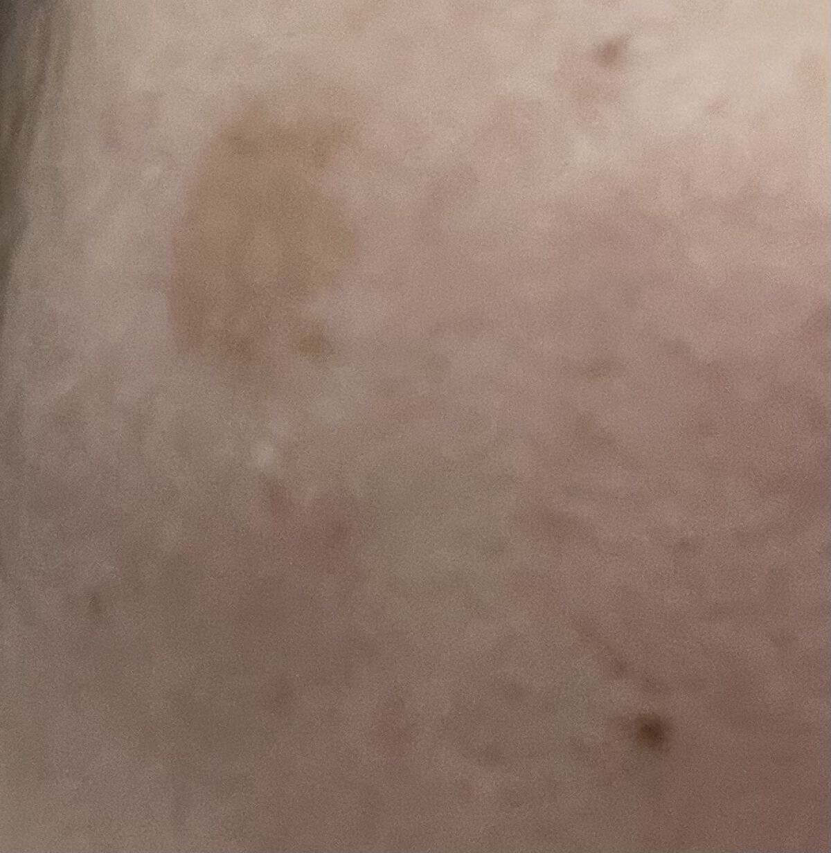 スポッツカバー ファウンデイション （ベースカラー）H101/SHISEIDO/クリームコンシーラーを使ったクチコミ（1枚目）