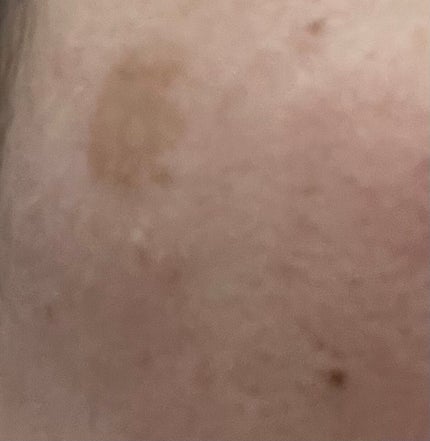 スポッツカバー ファウンデイション/SHISEIDO/クリームコンシーラーを使ったクチコミ(1枚目)