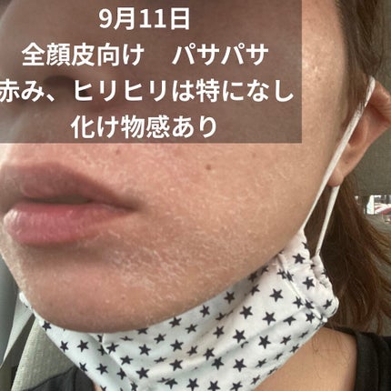 を使ったクチコミ(2枚目)