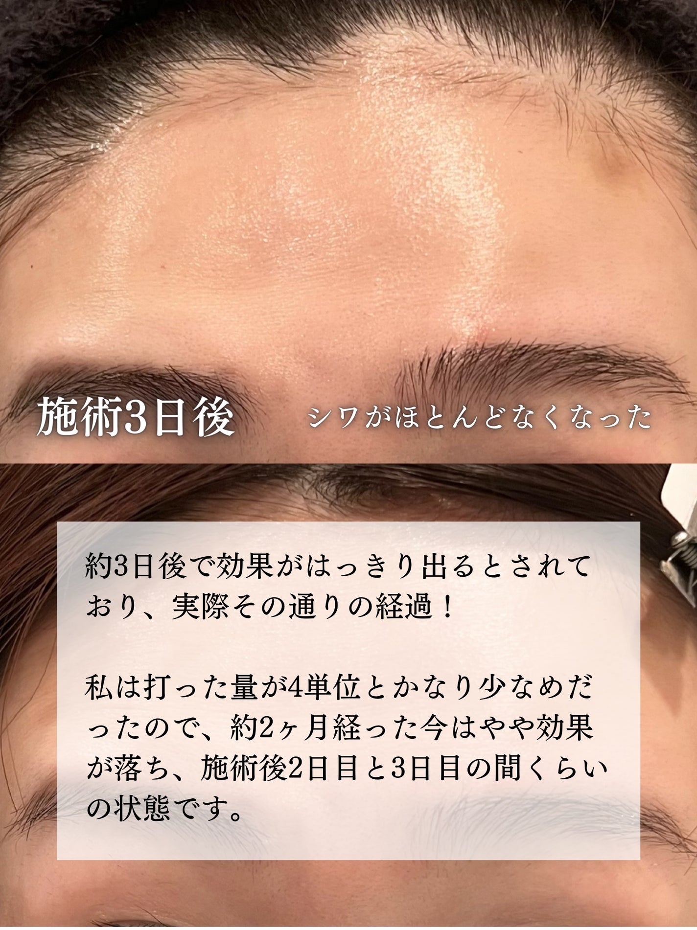 loco on LIPS 「\額ボト悩んでる人見て/これまで肌管理含め一切美容医療に手を出..」(4枚目)