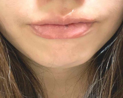 メルティクリームリップ/メンソレータム/リップクリームを使ったクチコミ(2枚目)