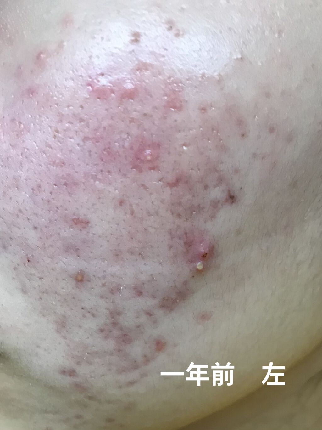 化粧水 ノンアルコールタイプ/ちふれ/化粧水を使ったクチコミ（2枚目）