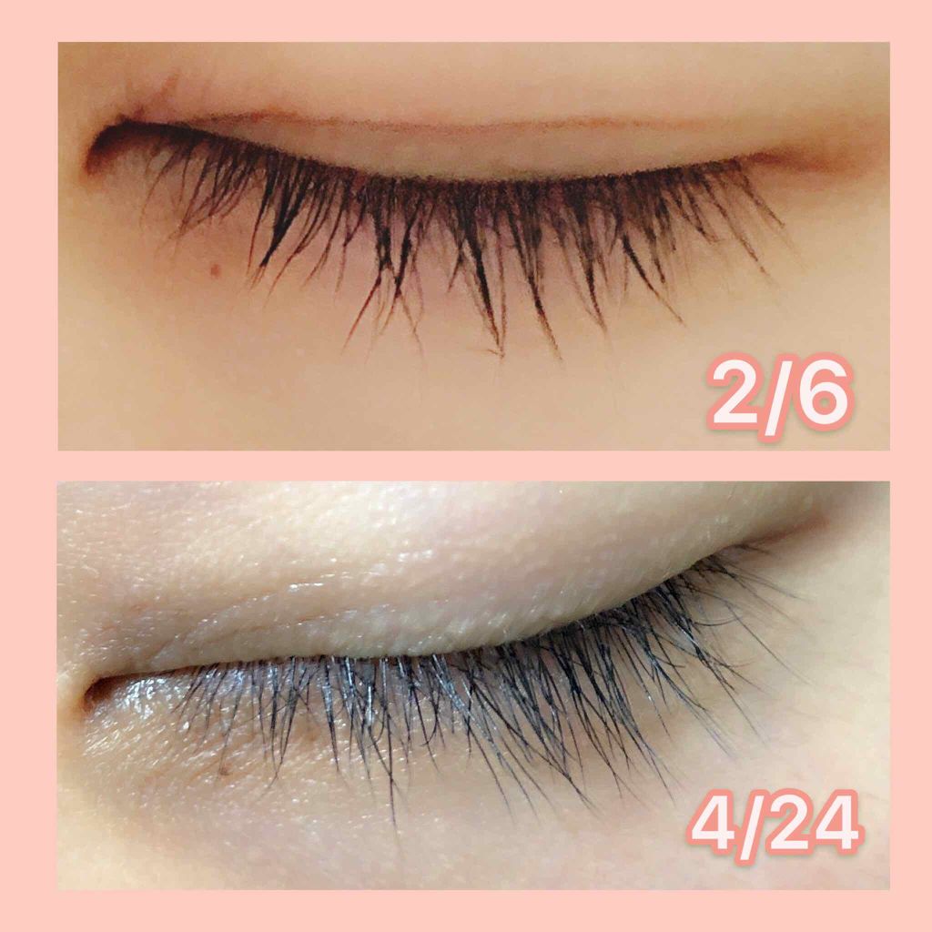 スカルプD ボーテ ピュアフリーアイラッシュセラム/アンファー(スカルプD)/まつげ美容液を使ったクチコミ(3枚目)