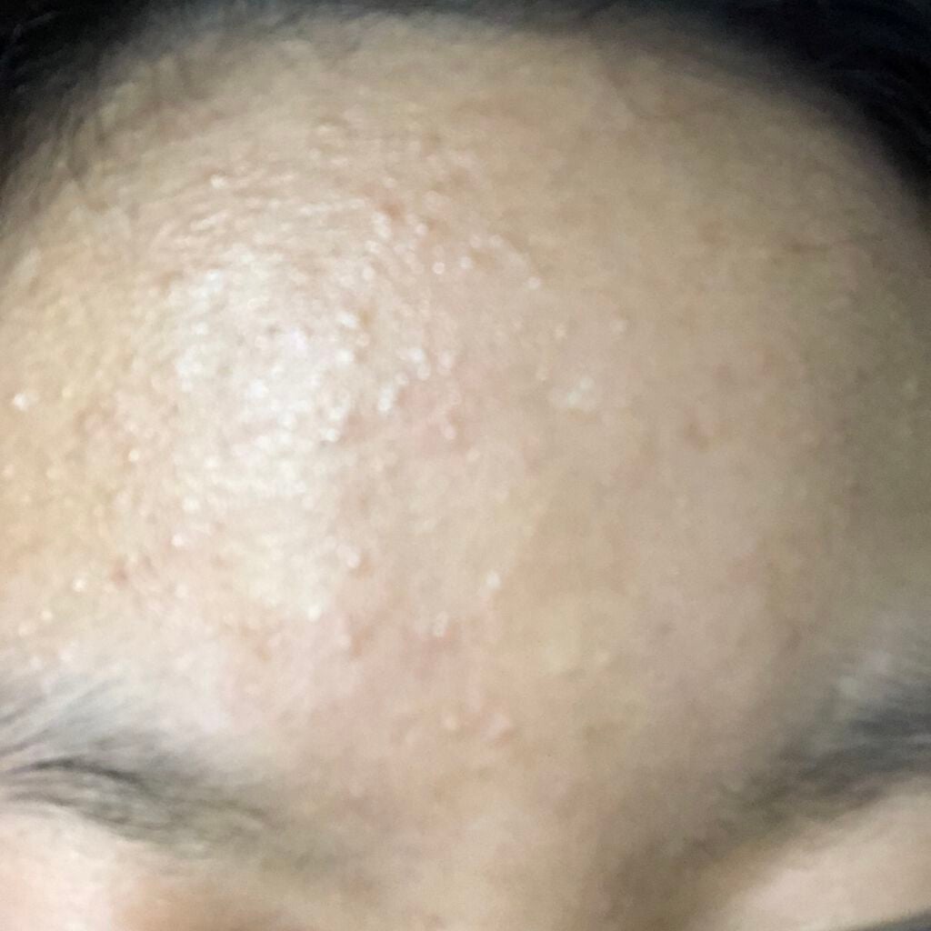 化粧水・敏感肌用・高保湿タイプ/無印良品/化粧水を使ったクチコミ(4枚目)