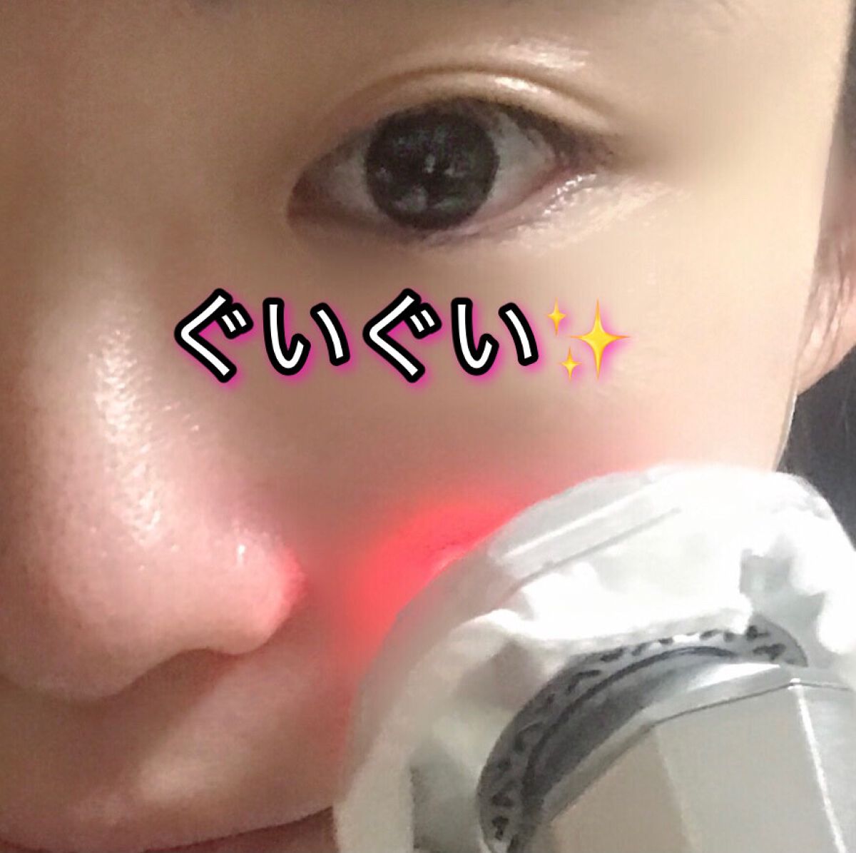 多機能温冷美顔器/ANLAN/美顔器・マッサージを使ったクチコミ(2枚目)