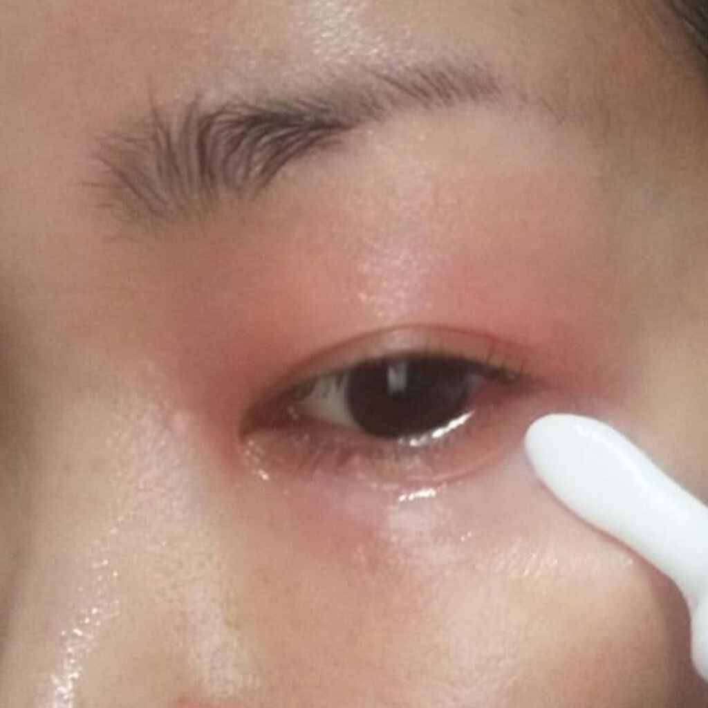 lujo ニードルセラム/lujo/美容液を使ったクチコミ(4枚目)