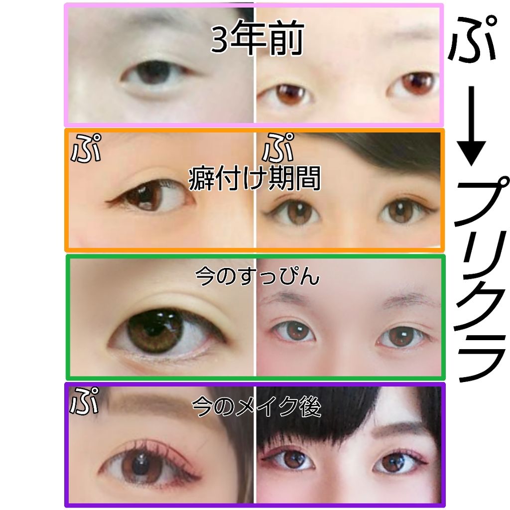 アイトーク/アイトーク/二重まぶた用アイテムを使ったクチコミ（2枚目）