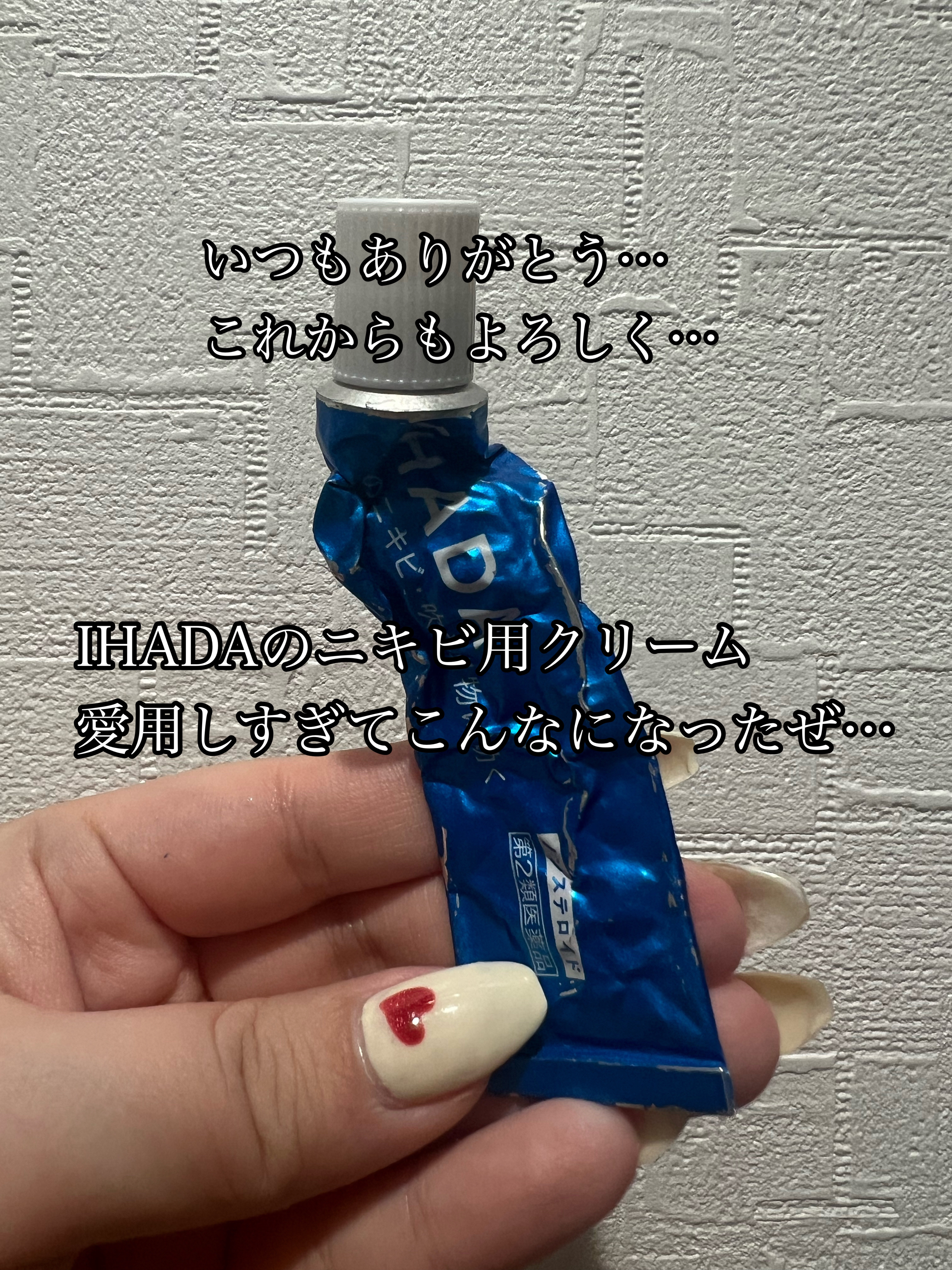 アクネキュアクリーム(医薬品)/IHADA/その他を使ったクチコミ（1枚目）