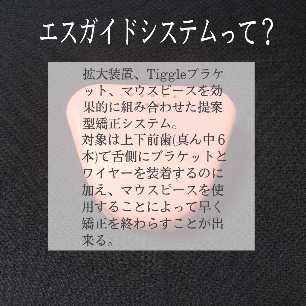 マウスピース矯正/その他を使ったクチコミ（2枚目）