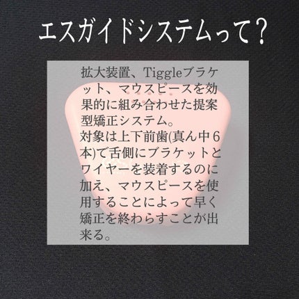 マウスピース矯正/その他を使ったクチコミ(2枚目)