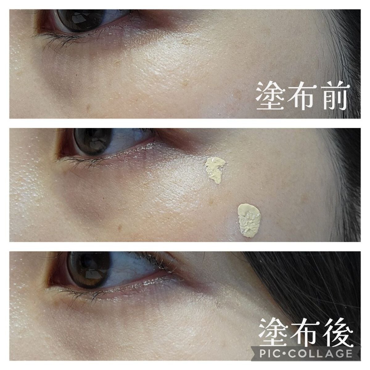 タトゥーウォータープルーフスカーコンシーラー/フォレンコス/リキッドコンシーラーを使ったクチコミ(5枚目)