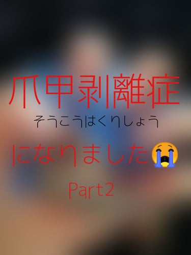 前回上げた爪甲剥離症の記事から約2週間程経ちましたので経過報告致します🎉


結論から言うと…

かなり良くなったのでは…！？🙌🏻💕


寝落ちてしまって夜塗り忘れたり、仕事の合間にこまめに塗る時間が無くて日中のケアを怠ってしまったりしていたのですが…特に酷かった左手(画像2枚目)の親指と人差し指がかなり改善されました！！すごい！！

ワセリンが凄いのかネイルオイルが凄いのか、はたまた元々治りかけていただけなのかは分かりませんが、爪甲剥離症は保湿が大事というのは本当なようです。

だがしかし3枚目の画像にも書いた通り、
以前は気にならなかった右手の中指の爪が少し剥がれてる…？
ほんとに少しですが、爪甲剥離症が増えたかもです😱
中指もちゃんと保湿してたのですが、もしかしたら気づかないうちに強い力を与えるようなことをしてしまったのかもしれません。

とはいえ、完治までもう一息！
引き続きがんばりまーす！✨

#爪甲剥離症治すマン
の画像 その0