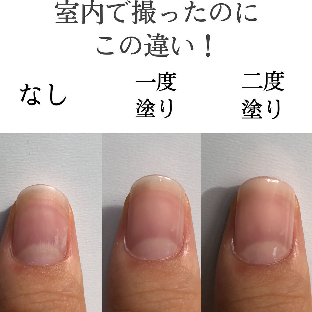 ベースコート 無印良品の口コミ ネイルの下地だけども単体だけでも可愛い By むーん 混合肌 10代後半 Lips ベースコート 無印良品の口コミ ネイルの下地だけども単体だけでも可愛い By むーん 混合肌 10代後半 Lips