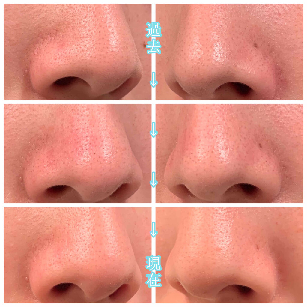 艶肌ドロップ/ラッシュ/美容液を使ったクチコミ（2枚目）