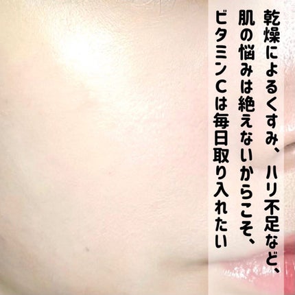 おゆたん on LIPS 「世界で愛される🌎💓純粋(ピュア)ビタミンの美容液「SKカラビ..」(6枚目)