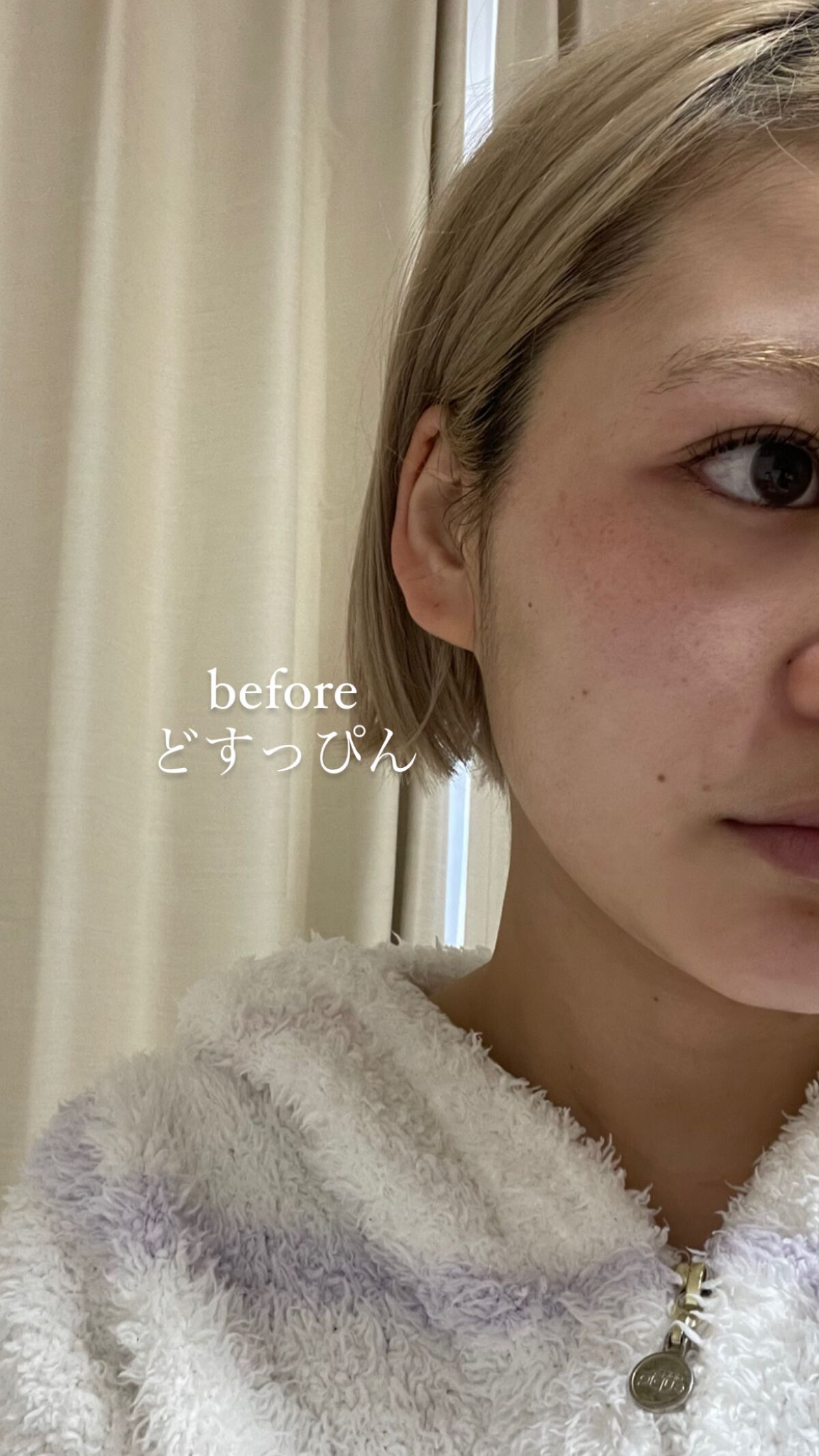 ロングラスティングチップコンシーラー/LUNA/リキッドコンシーラーを使ったクチコミ（1枚目）