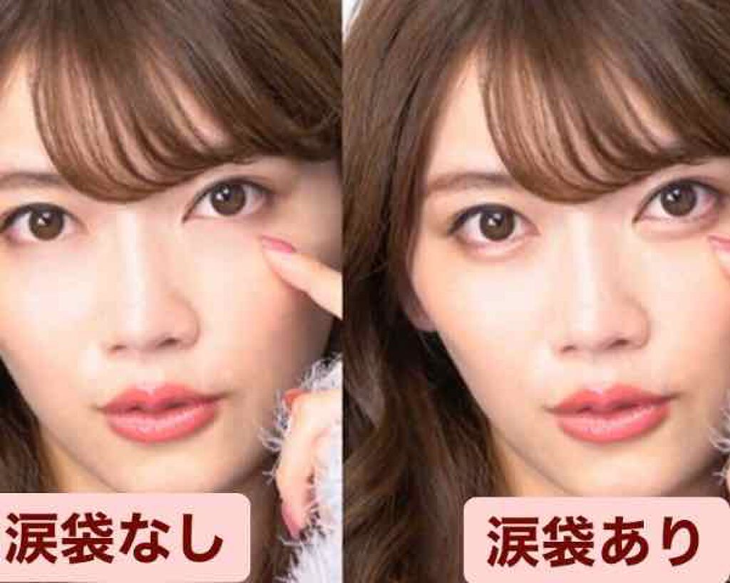 しゅり@小顔専門トレーナー on LIPS 「真顔のときや集合写真を撮ると涙袋がなくて目が豆粒のように小さく..」(3枚目)